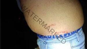 Briga em bar deixa homem ferido por golpe de canivete em Formosa