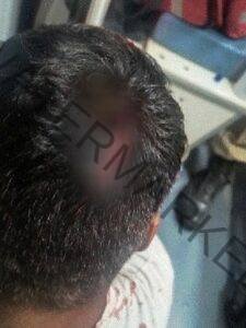 Jovem é agredido a pauladas após acusação de importunação sexual em Formosa